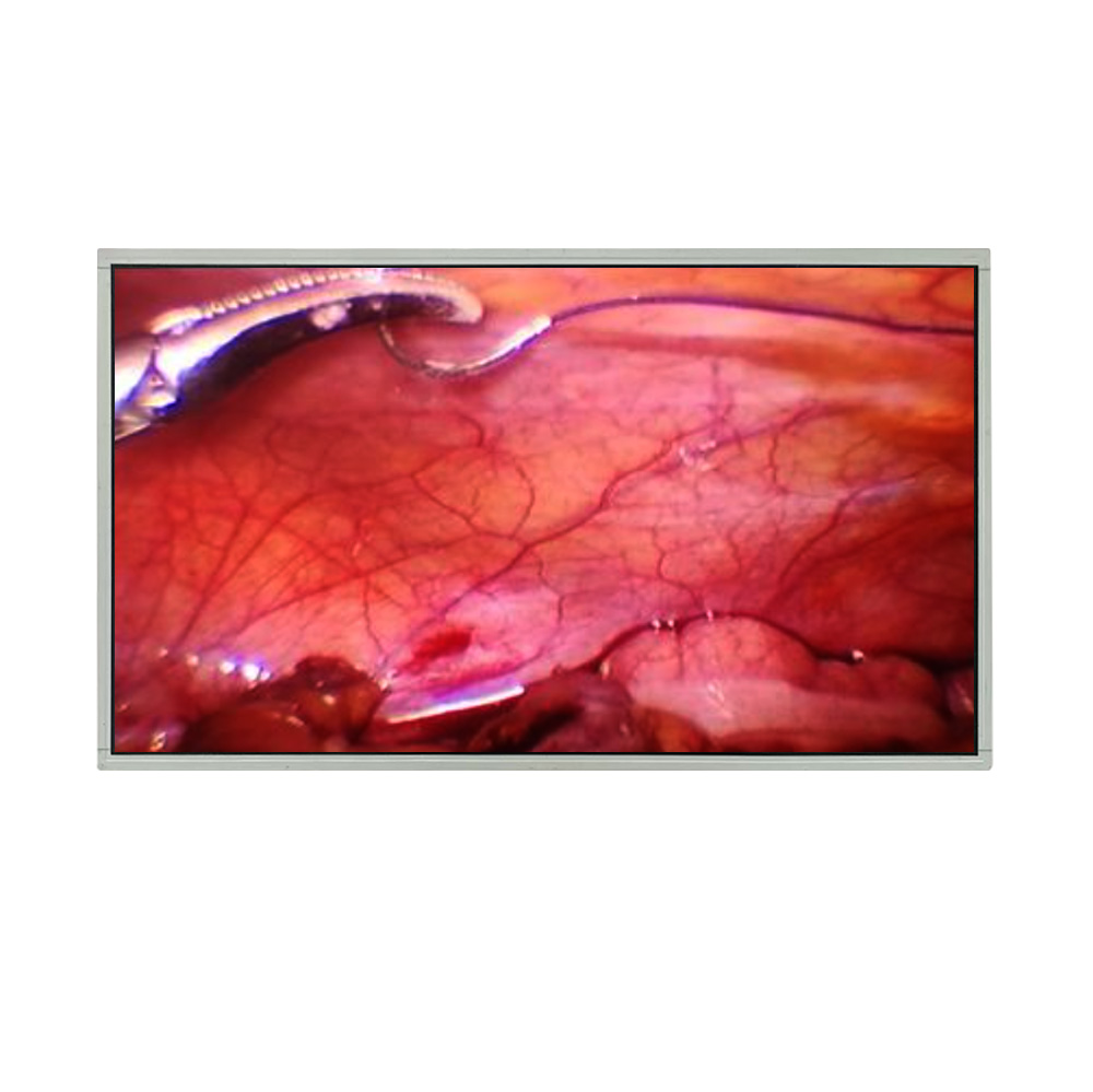 Medical Monitors and Displays: Innovations Shaping Modern Healthcare