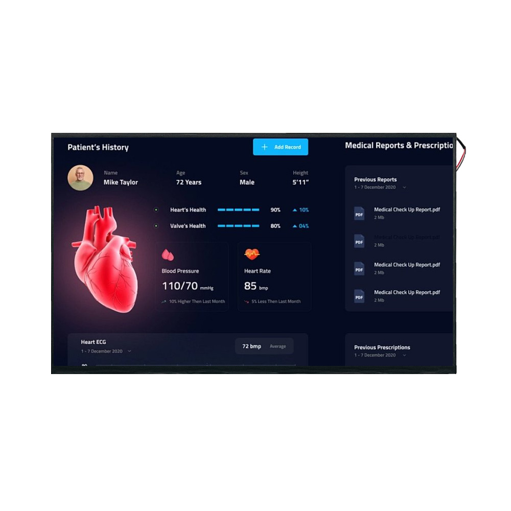 15.6-Inch 4K Medical Display Module for High-Precision Diagnostic Imaging