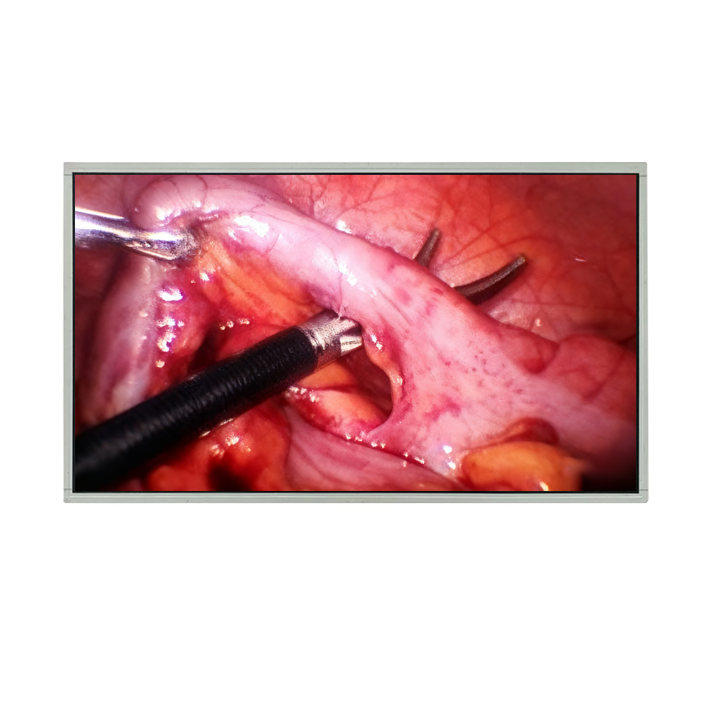 Medical LCD Display: Key Requirements, Applications, and Technology Trends